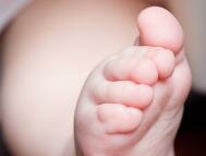 Деформация стопы ребенка: Как исправить плоскостопие? 