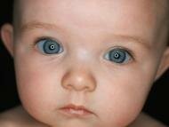 Малыш с широко закрытыми глазами!: Как быть, если долгожданный ребенок родился слепым?
