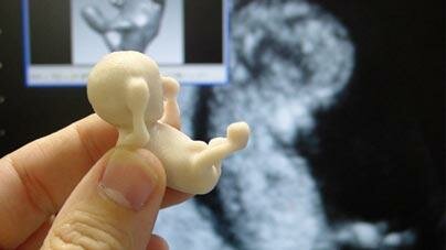 Беременность и современные технологии: Куклы-эмбрионы - что это?