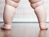 Макросомия: Почему развивается гигантизм у детей?